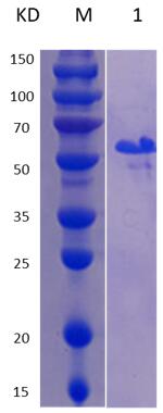 12% SDS-PAGE analysis profiles of purified MCR_RS03640-32-322 (CBB stained).